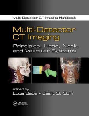 Tapa de Multidetector Ct Imaging