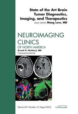 Tapa de Brain Tumor Imaging