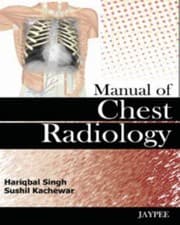 Tapa de Manual Of Chest Radiology