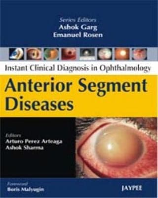 Tapa de Anterior Segment Diseases