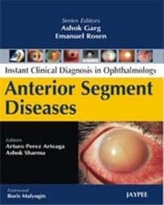 Tapa de Anterior Segment Diseases