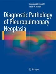 Tapa de Diagnostic Pathology Of Pleuropulmonary Neoplasia