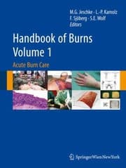 Tapa de Handbook Of Burns
