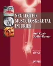 Tapa de Neglected Musculoskeletal Injuries