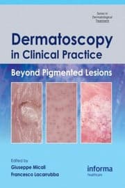 Tapa de Dermatoscopy In Clinical Practice Beyond Pigmented Lesions