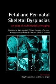 Tapa de Fetal And Perinatal Skeletal Dysplasias An Atlas Of Multimodality Imaging