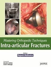 Tapa de Intraarticular Fractures