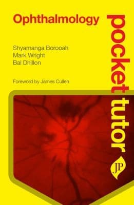 Tapa de Pocket Tutor Ophthalmology