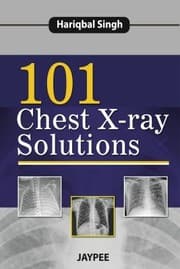 Tapa de 101 Chest Xray Solutions