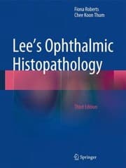 Tapa de Lees Ophthalmic Histopathology