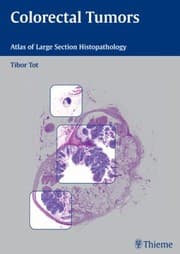 Tapa de Colorectal Tumors Atlas Of Large Section Histopathology