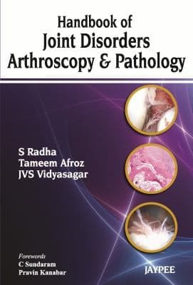 Tapa de Synovium The Arthroscopy And Pathology