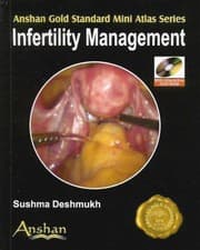 Tapa de Infertility Management