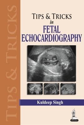 Tapa de Tips  Tricks in Fetal Echocardiography
