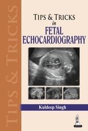Tapa de Tips Tricks in Fetal Echocardiography