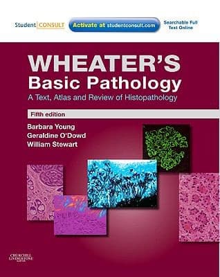 Tapa de Wheaters Basic Pathology
            
                Basic Histopathology Wheaters Burkitt