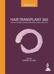 Tapa de Hair Transplant 360