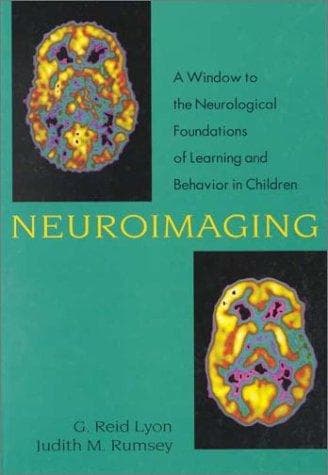 Tapa de Neuroimaging