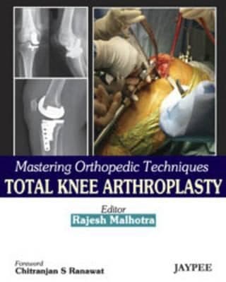 Tapa de Mastering Orthopedic Techniques Total Knee Arthroplasty