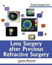 Tapa de Lens Surgery After Previous Refractive Surgery