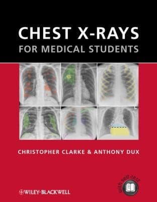 Tapa de Chest Xrays For Medical Students