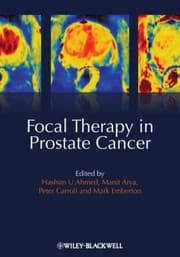 Tapa de Focal Therapy in Prostate Cancer