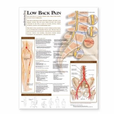Tapa de Understanding Low Back Pain Anatomical Chart