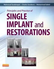Tapa de Principles And Practice Of Single Implant And Restorations