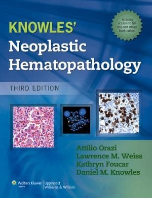 Tapa de Knowles Neoplastic Hematopathology