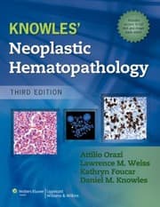 Tapa de Knowles Neoplastic Hematopathology