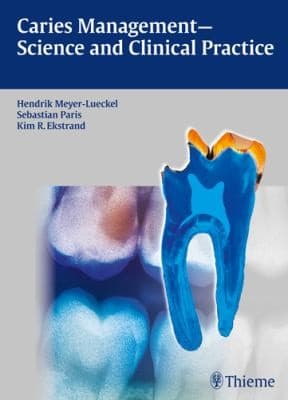 Tapa de Caries Management Science And Clinical Practice