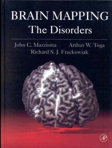 Tapa de Brain mapping