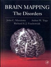 Tapa de Brain mapping