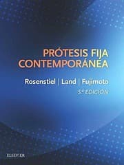 Tapa de Prótesis fija contemporánea