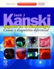 Tapa de Signos en oftalmología : causas y diagnóstico diferencial