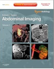 Tapa de Abdominal imaging