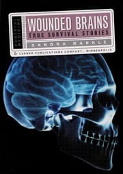 Tapa de Wounded brains