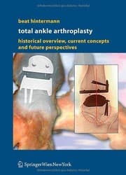 Tapa de Total Ankle Arthroplasty: Historical Overview, Current Concepts and Future Perspectives