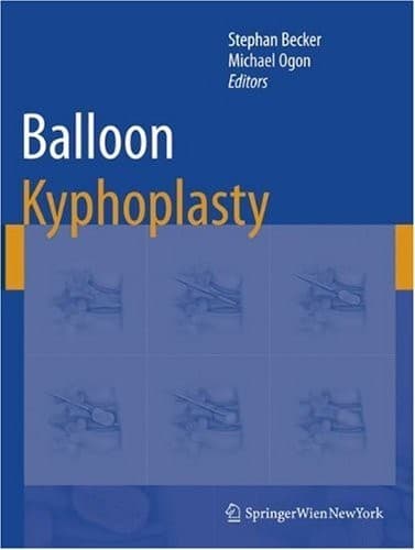 Tapa de Balloon Kyphoplasty