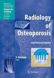 Tapa de Radiology of Osteoporosis (Medical Radiology)