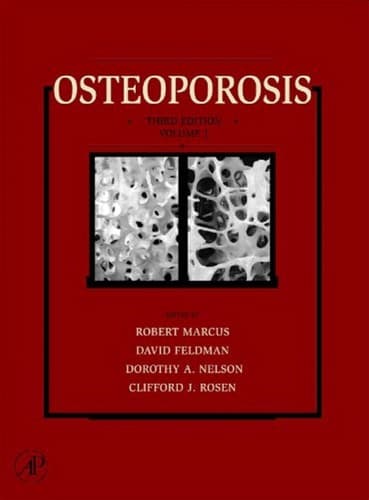 Tapa de Osteoporosis