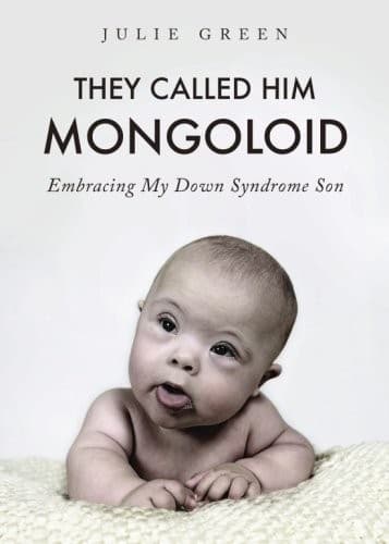 Tapa de They Called Him Mongoloid