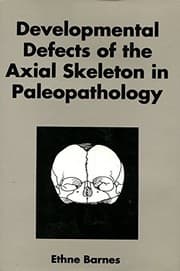 Tapa de Developmental defects of the axial skeleton in paleopathology