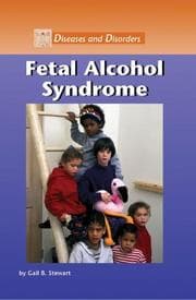 Tapa de Fetal alcohol syndrome
