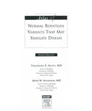 Tapa de Atlas of normal roentgen variants that may simulate disease