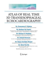 Tapa de Atlas of Real Time 3D Transesophageal Echocardiography