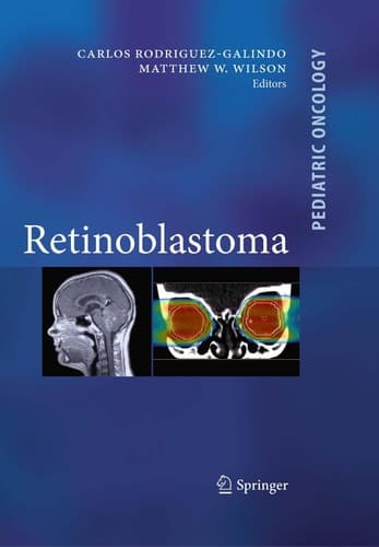 Tapa de Retinoblastoma