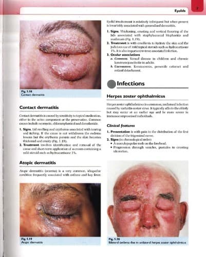 Tapa de Clinical ophthalmology