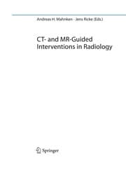 Tapa de CT- and MR-Guided Interventions in Radiology