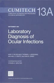 Tapa de Laboratory diagnosis of ocular infections